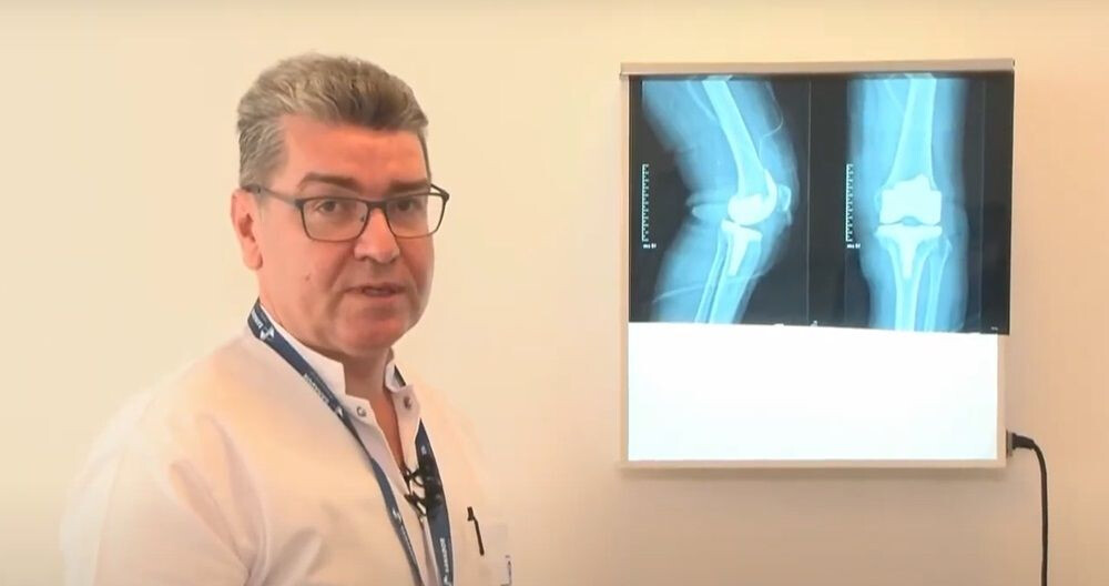 Dr. Liviu Ojoga, șeful Secției de Ortopedie-Traumatologie la la Spitalul Clinic SANADOR, lângă un ecran care arată radiografie cu protezare bilaterală de genunchi.
