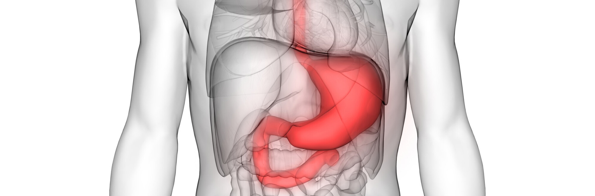 cancer gastric simptomatologie)