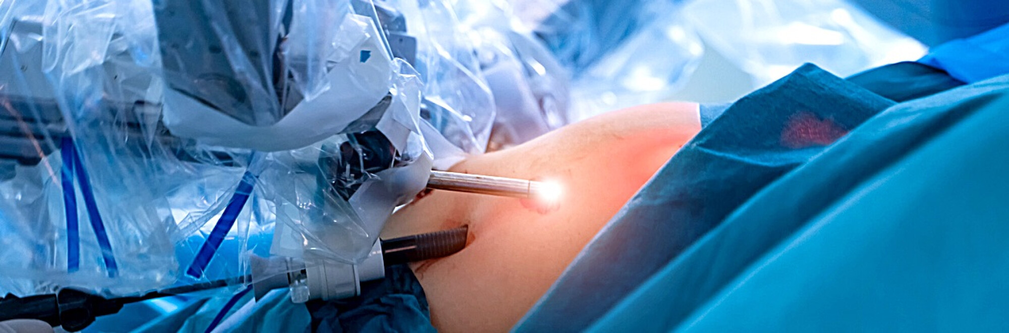 Chirurgie de decompresie lombară – Riscuri