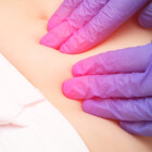 Cancerul ovarian diagnosticat în timpul sarcinii