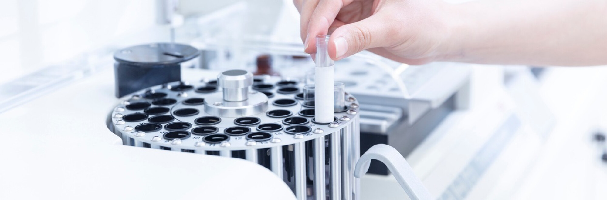 Ce Este Hemoleucograma 2 Hemoleucograma | Test pentru diagnosticul bolilor hematologice