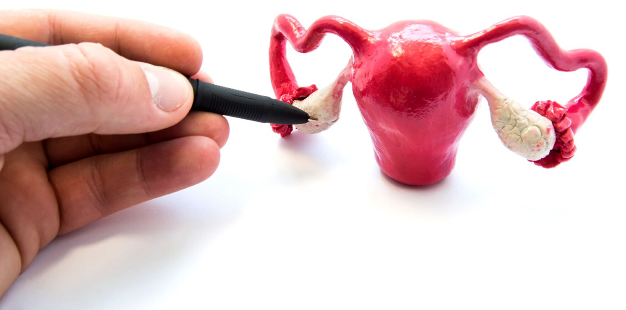 pierderea în greutate și sindromul ovarian polichistic