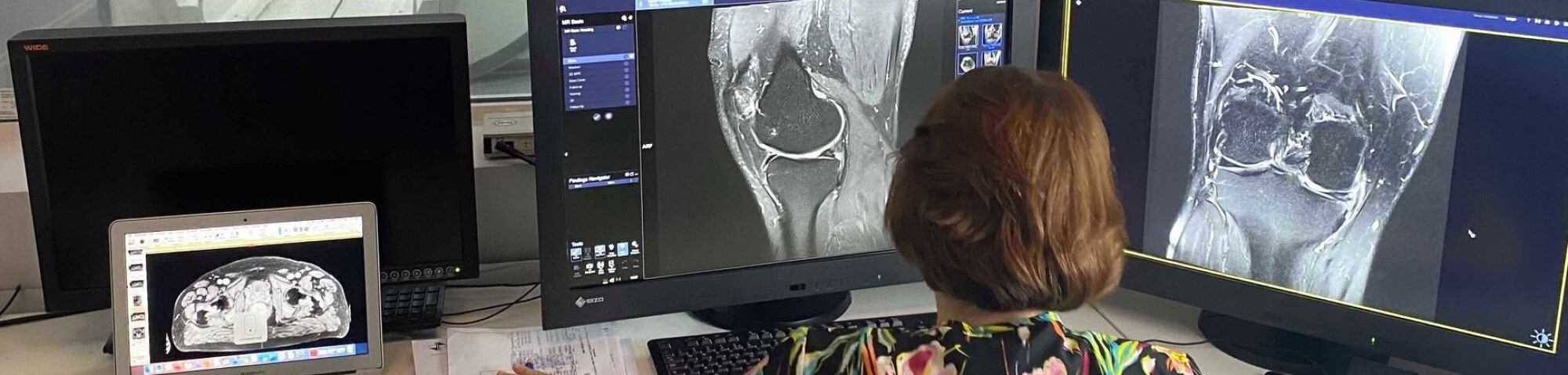 proteus cu prostatita este prostatita vindecabilă la o vârstă fragedă?