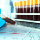 Dozare cantitativă de anticorpi anti-SARS-CoV-2 IgG (anti-spike RBD) la SANADOR