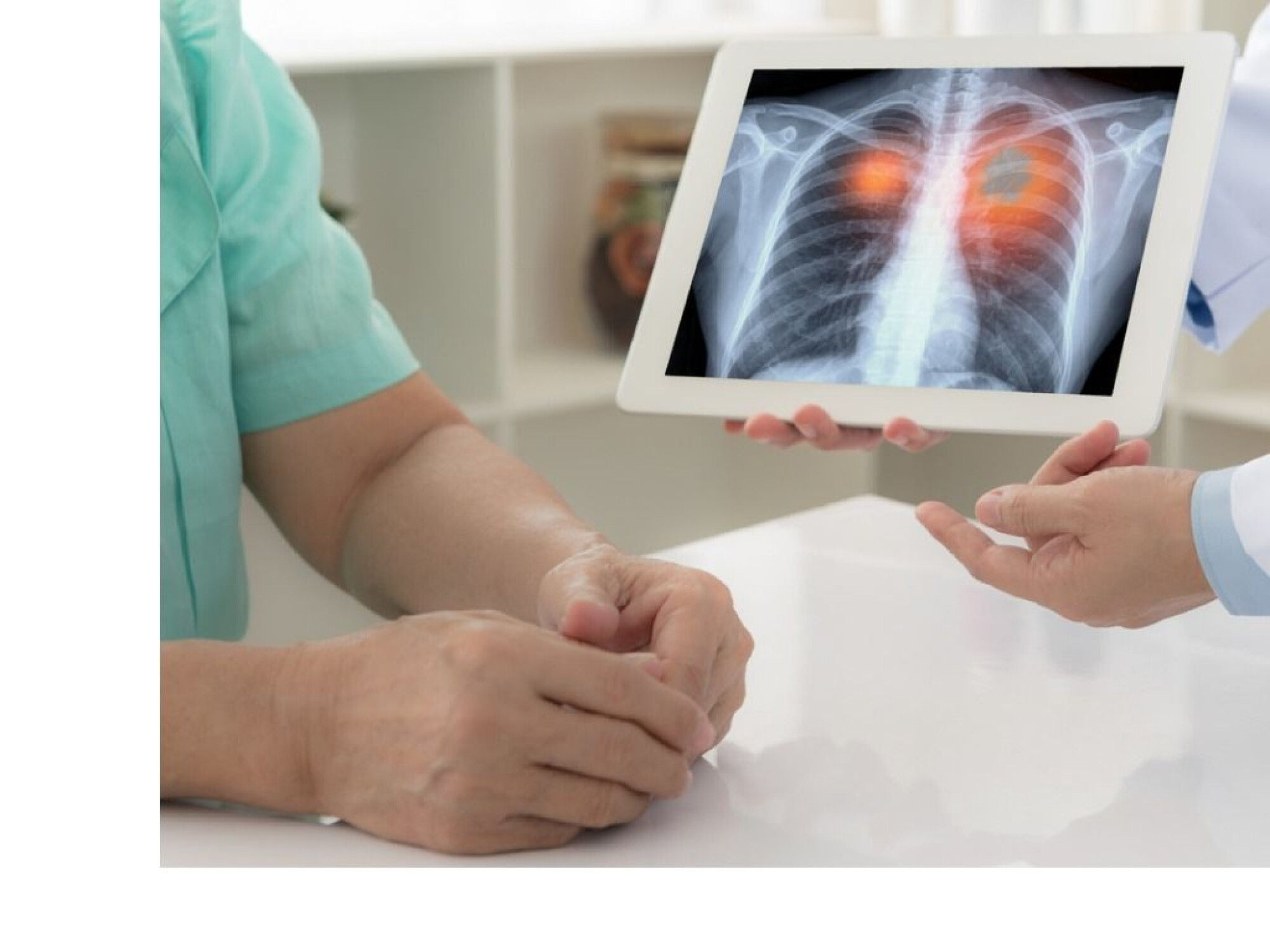 cum să faci cancerul pulmonar rapid urmărește bitcoin